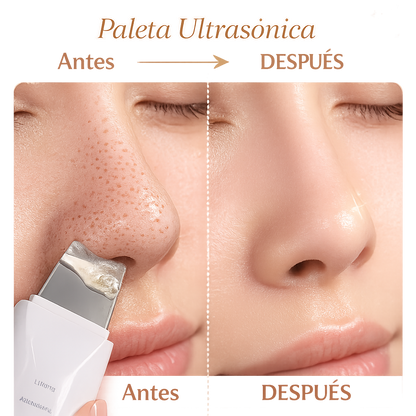 LumiSkin™ - Paleta Ultrasónica Facial